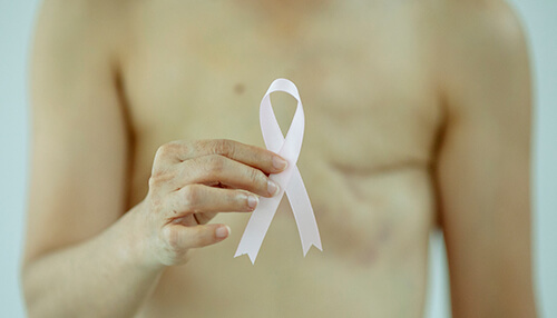 Who can get a mastectomy Person holding a white breast cancer awareness ribbon after mastectomy surgery, symbolizing strength and recovery