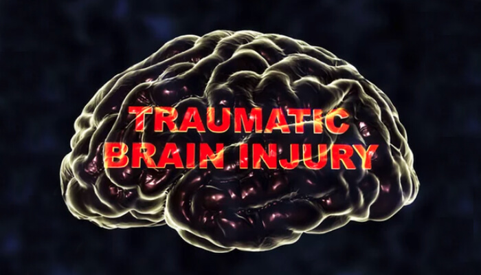 Traumatic Brain Injury : Tips for Supporting With a TBI