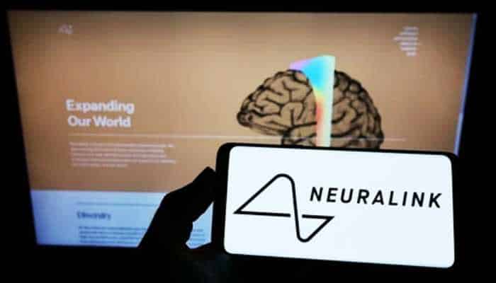 Elon Musk implants the Neuralink device in a human patient. Elon Musk implants the Neuralink device in a human patient.