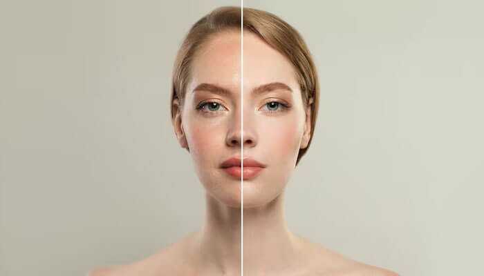 Self-esteem Skin rejuvenation self-esteem