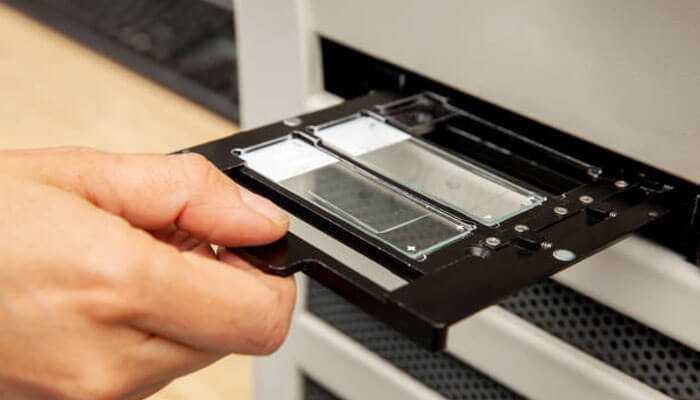 Retrieval doesnt have to be a team sport - tycoonstory | tycoonstory media Scientist placing microscope slides into a lab equipment tray for sample testing and analysis.
