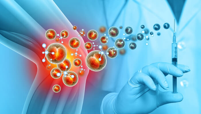 What conditions are treated with stem cells | tycoonstory media What conditions are treated with stem cells