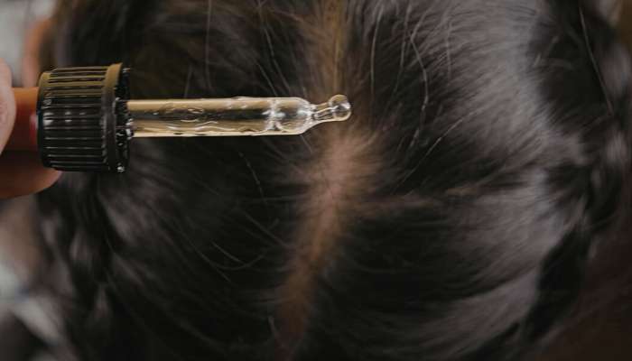 Scalp health 1 | tycoonstory media Close-up of a dropper releasing clear liquid onto the scalp at a part in dark hair, suggesting a hair treatment.