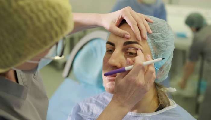 What blepharoplasty can address | tycoonstory media Medical professional marks near a patient's eye while another person steadies the head in an operating room.
