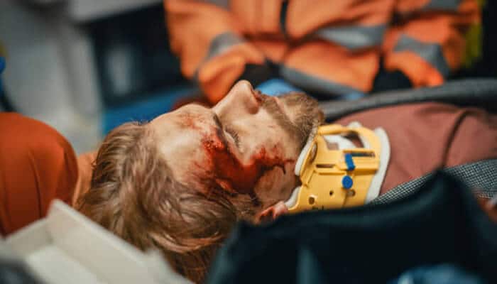 When injuries are catastrophic | tycoonstory media When injuries are catastrophic