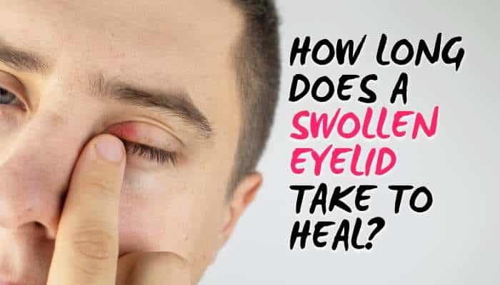 What is the fastest way to heal a swollen eyelid 1 | tycoonstory media What is the fastest way to heal a swollen eyelid while reducing inflammation and speeding up recovery naturally