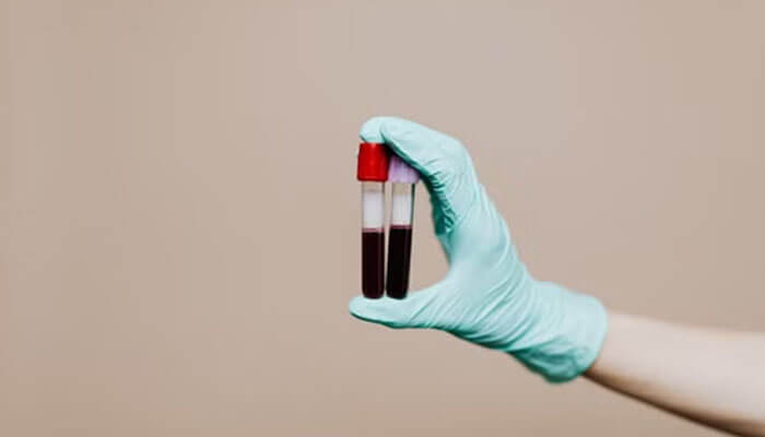 Recognizing patterns before they become bigger concerns - tycoonstory | tycoonstory media Gloved hand holding two blood sample tubes with red caps on a plain background.