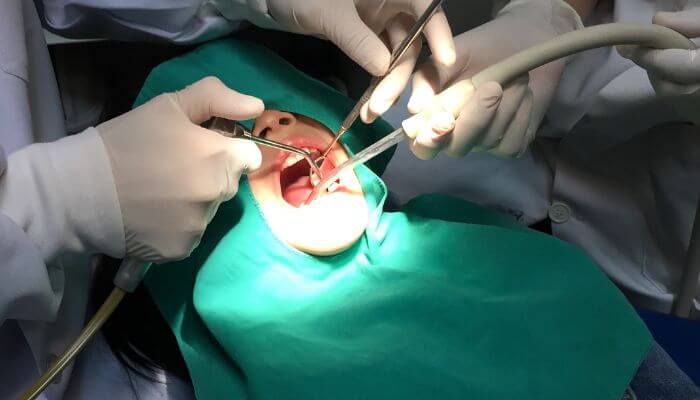 Hard bump after tooth extraction or dental surgery | tycoonstory media Dentist performing oral surgery for a hard bump on gums by molar