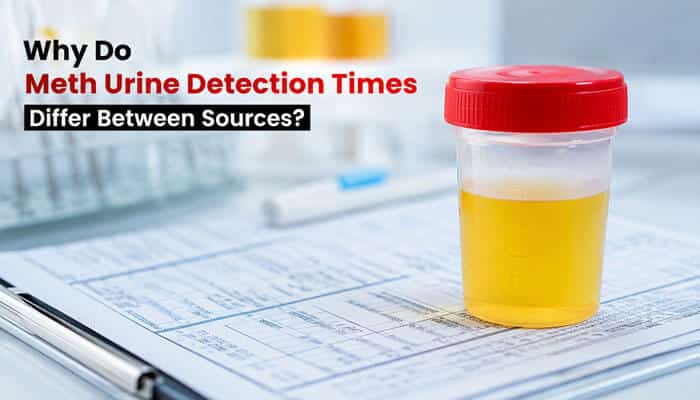 Why do meth urine detection times differ between sources - tycoonstory | tycoonstory media How long does meth stay in your system for urine sample testing, illustrated with a realistic urine specimen cup in a clinical laboratory.
