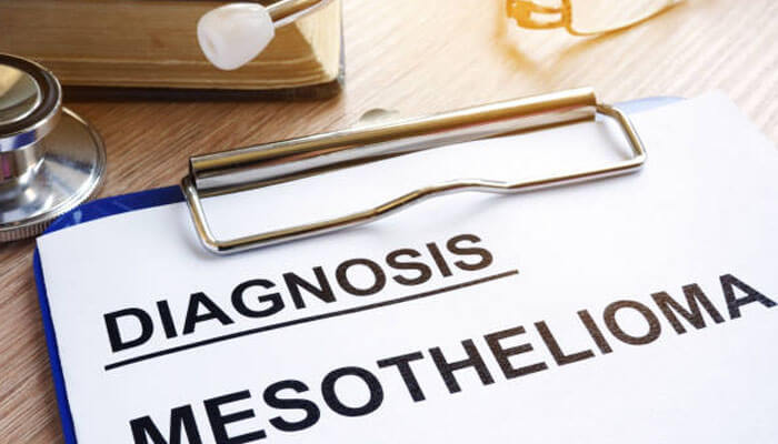Why a mesothelioma diagnosis can raise questions about the past | tycoonstory media